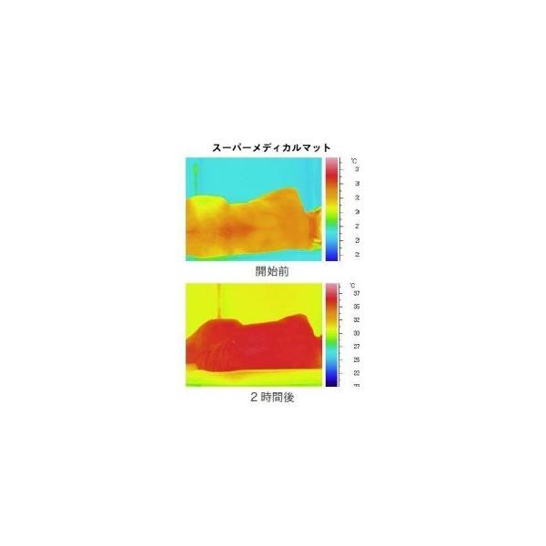 スーパーメディカルマット携帯用 /【Buyee】 