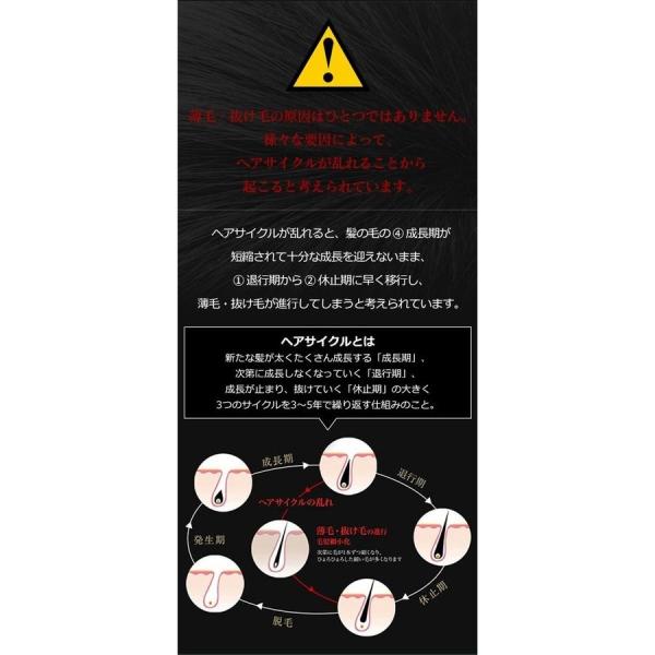 3つの発毛理論で発毛力を引き出す、薬用育毛剤。プレミアムグロー ...