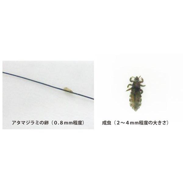 アタマジラミ 頭しらみ シラミ駆除櫛 くし ニットフリーコーム