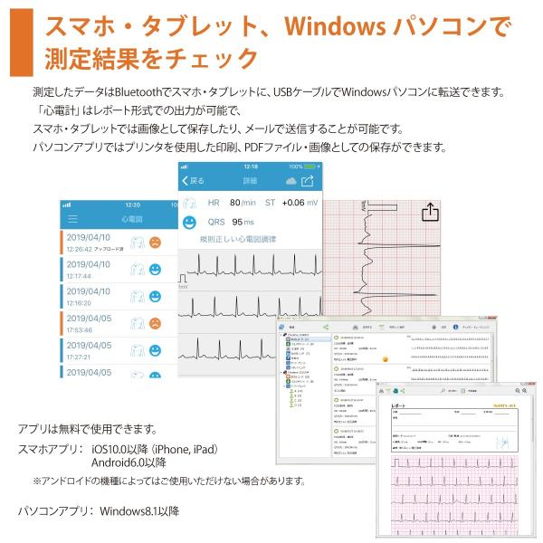 チェックミーECG アドバンスモデル 心電計 携帯型心電計 携帯用 家庭用 心電図計 ブルートゥース搭載 /【Buyee】 Buyee -  Japanese Proxy Service | Buy from Japan!