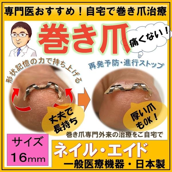 【2個セット】巻き爪治療器具 ネイルエイド 16mm 巻き爪治療 巻き爪矯正 自分で ネイルエイド 16mm ワイヤー