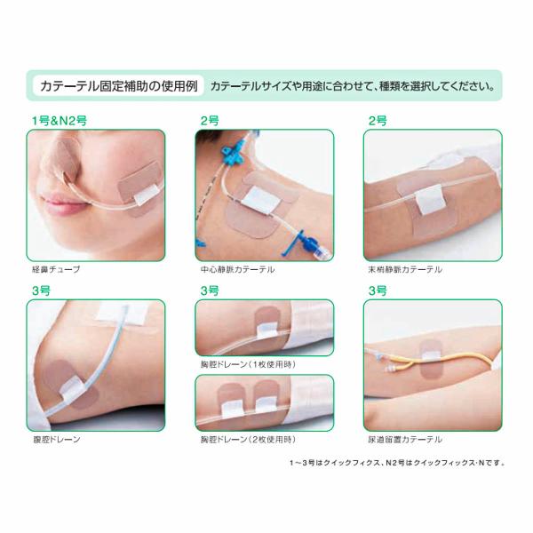 アルケア クイックフィックス 2号（20Fr以下 カテーテル固定テープ