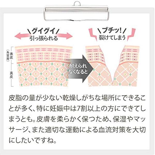 妊娠線クリーム 肉割れクリーム ２本セット できてしまった肉割れ