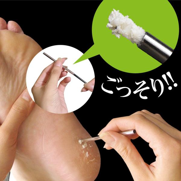 Sosu - Scratch Smart Callus Removal Tool