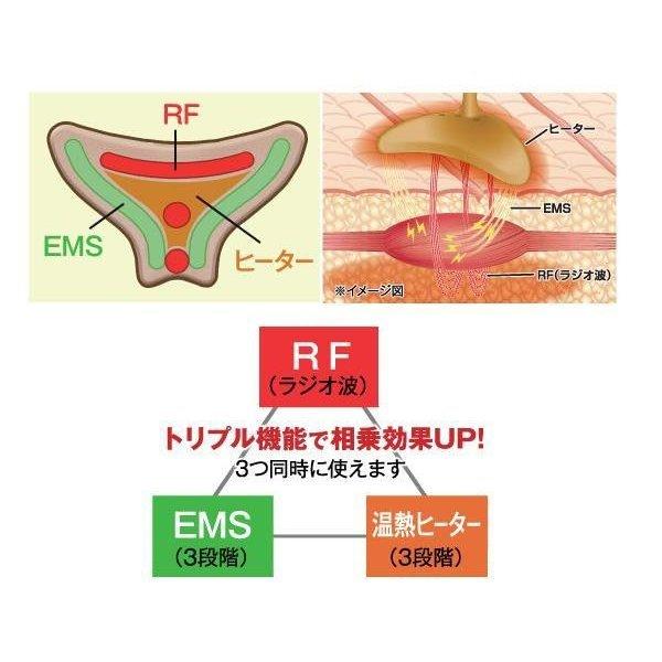 アイロン ナソラビアルフォールドES(美顔器 表情筋 ems シワ ケア rf