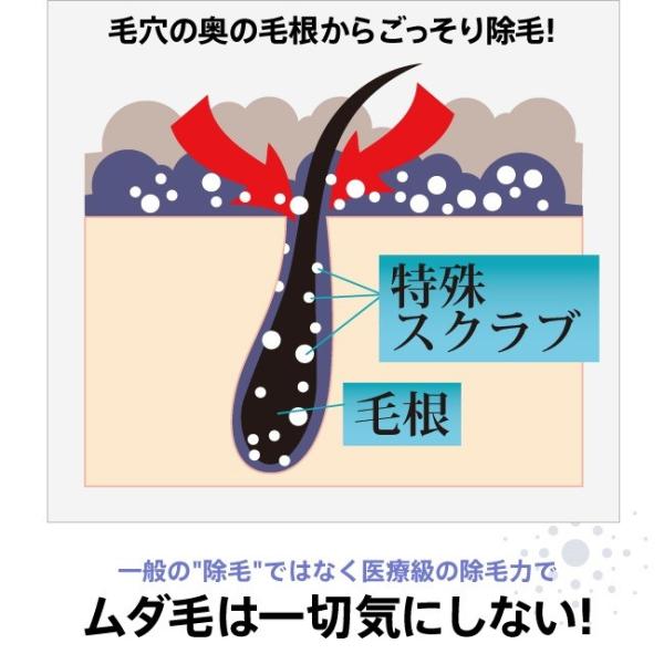 ミクロクリスタ スクラブインバスリムーバー 除毛クリーム  脱毛剤 ムダ毛処理 ミクロクリスタ スクラブインバスリムーバー(医薬部外品 除毛